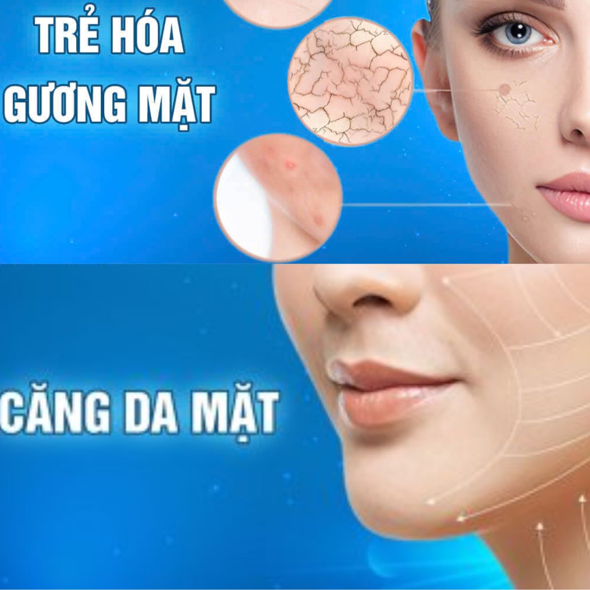 tre-hoa-guong-mat-3